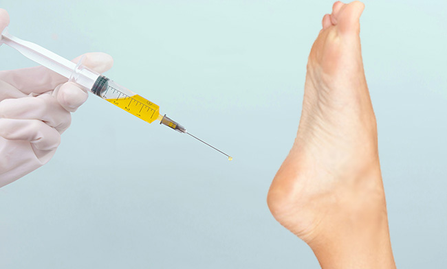 Injections are one way to relieve heel pain - Atlantic PT