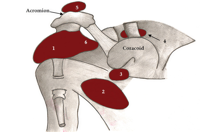 Shoulder Bursitis - Atlantic Physical Therapy
